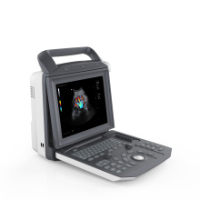 Zoncare Hospital Diagnose Tragbarer 3D -Ultraschall -Tragbarer PC -Basis -Ultraschall -Scanner